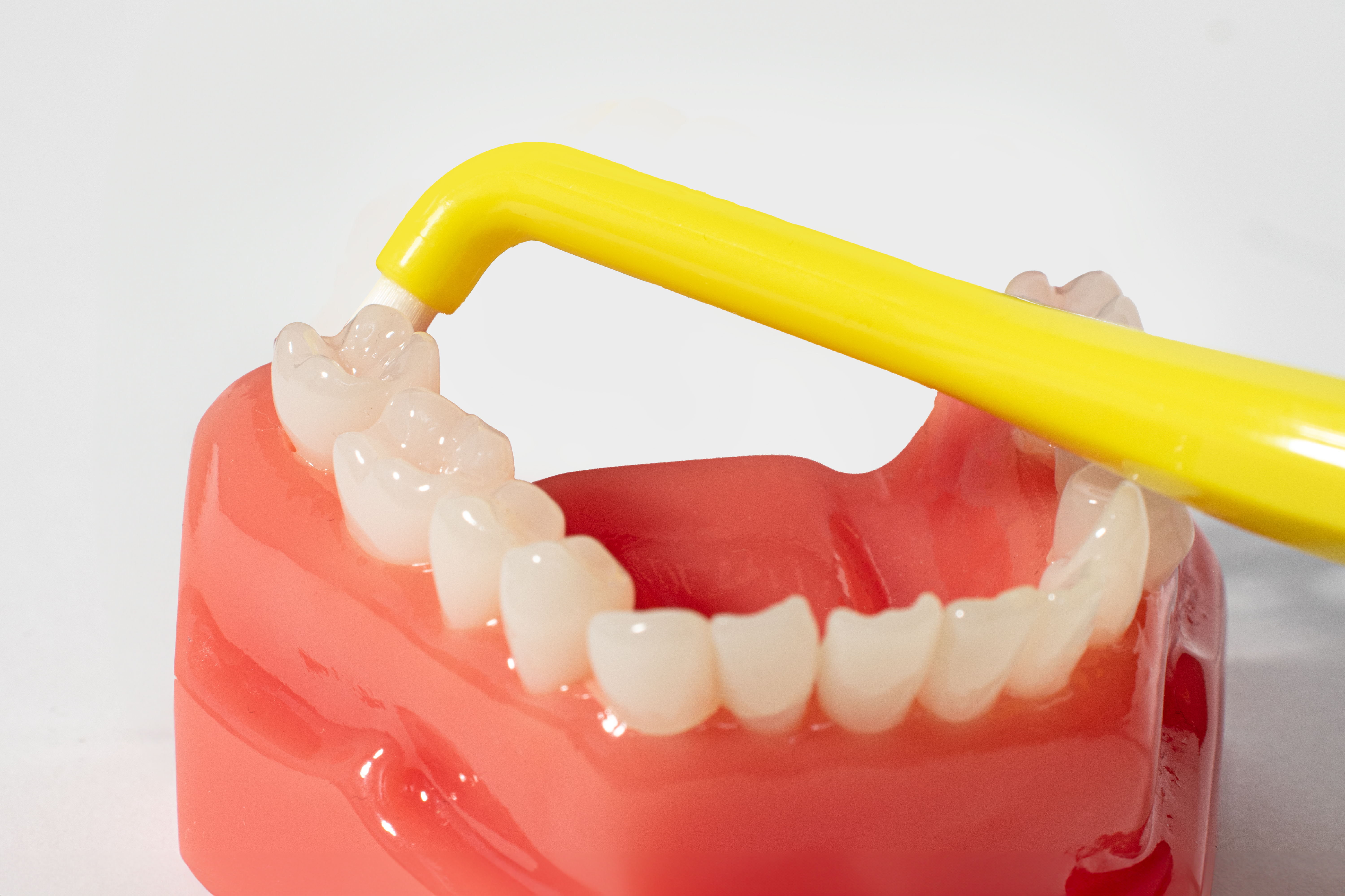 Royal Denta Single tuft kollane Royal Denta ühe hamba harjaga puhastamine