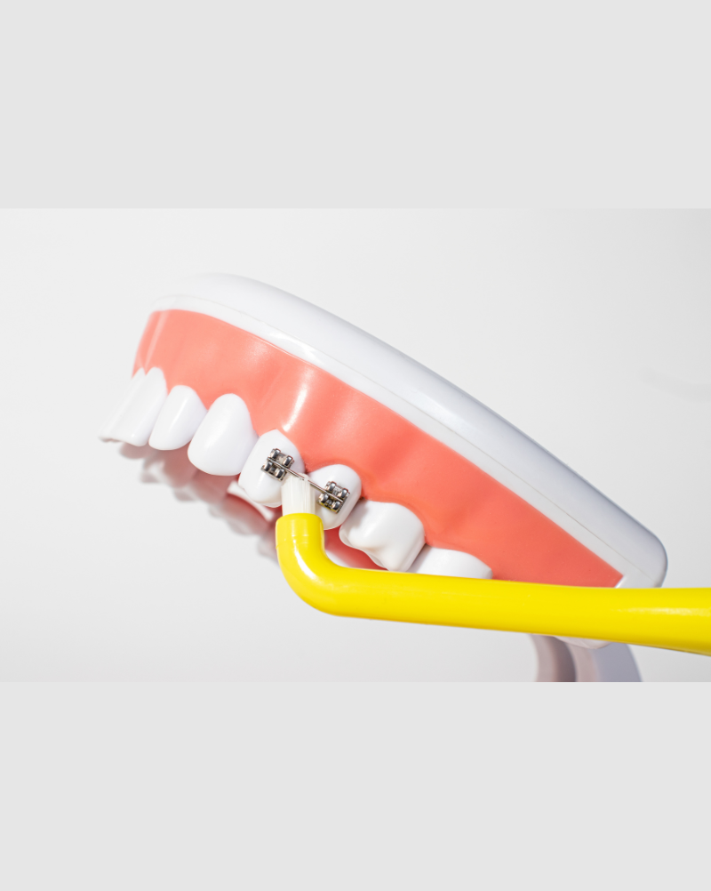 Hambahari Royal Denta Soft Silver Single-Tuft, kollane